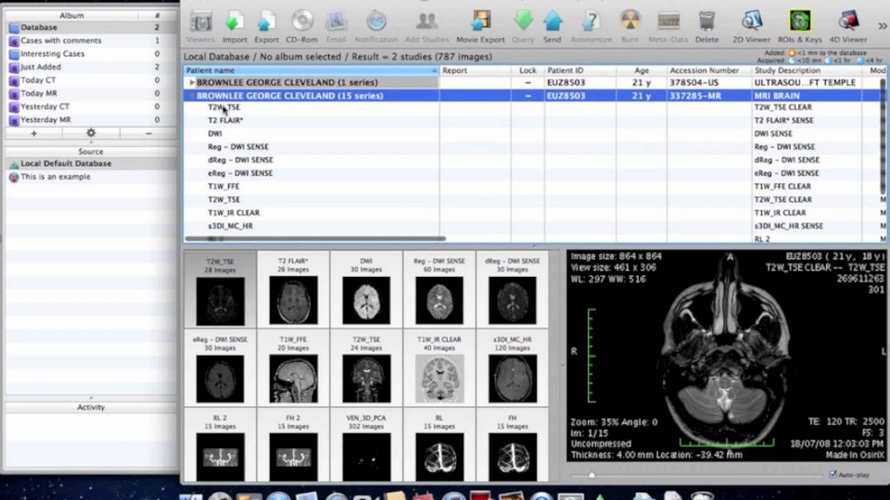 Mri Images Viewer For Mac